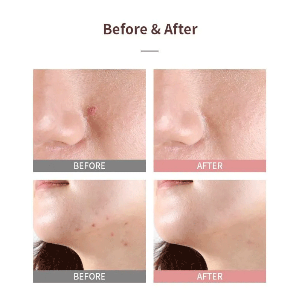 MIZON Good Bye Blemish Pink Spot 19ml - DODOSKIN