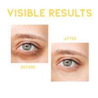 OOTD Dark Circle Eye Serum 30g - DODOSKIN