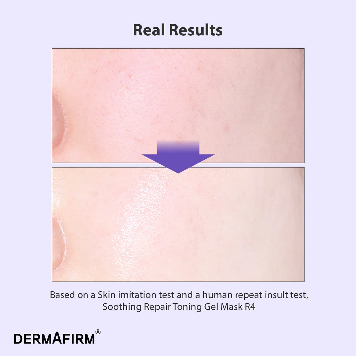 Dermafirm Soothing Reparación de toneladas de gel de tono R4 (4 hoja)