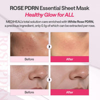 MEDIHEAL British White Rose PDRN Essential Mask Sheet Bio 10ea
