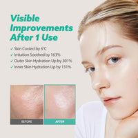 Leche Touch LHA HYALURON MASK DIARIA SOATHING 330G X 30 Hojas