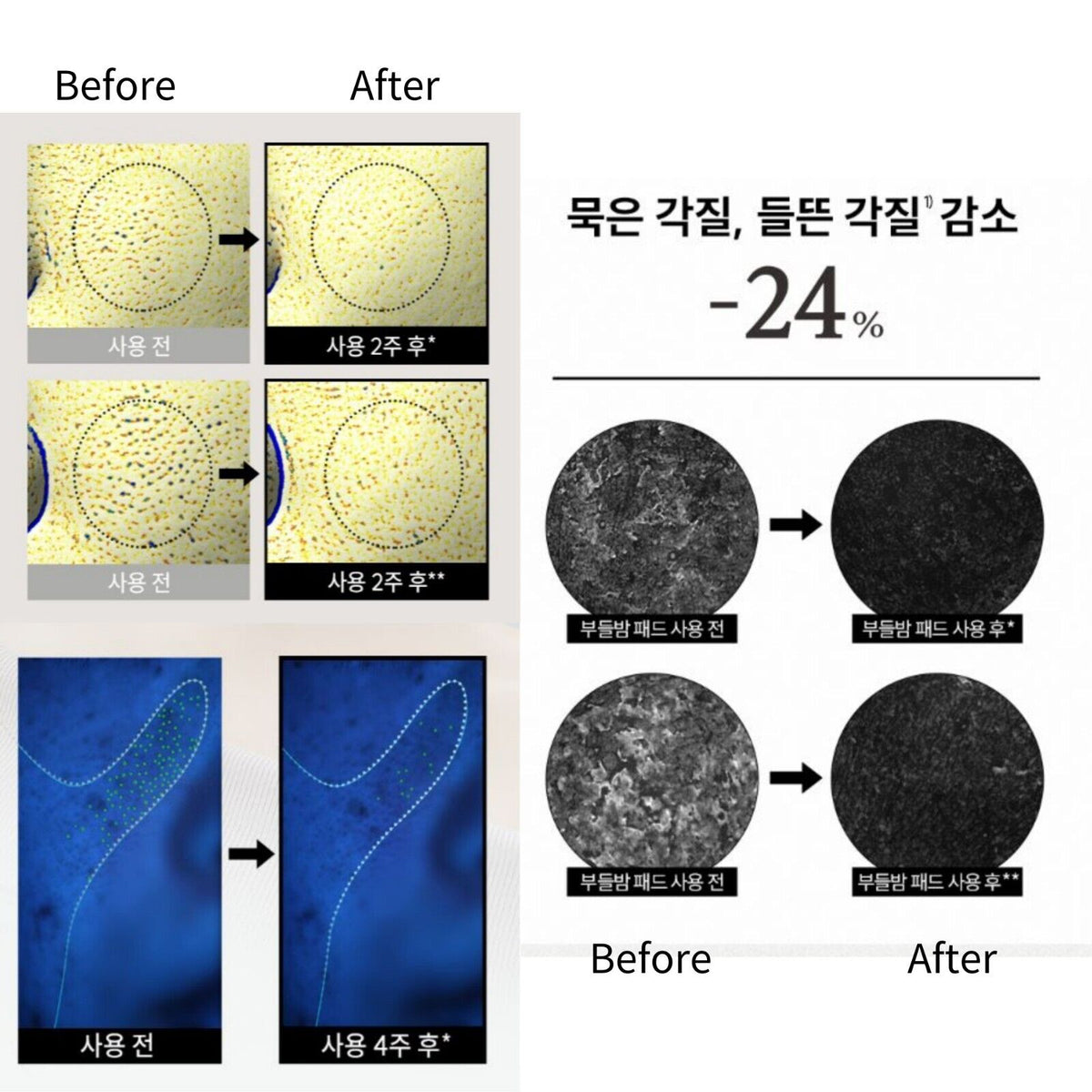HANYUL Chestnut Shell Pore-Tight Pads 150ml 50EA - Dodoskin